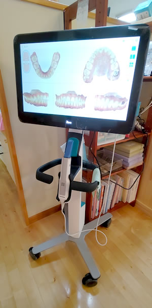 iTeroエレメント